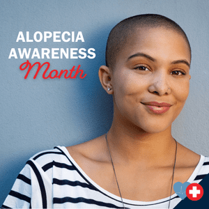 3 Things You Need to Know About Alopecia