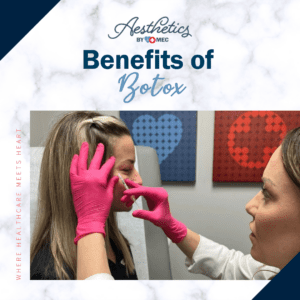 Benefits of Botox