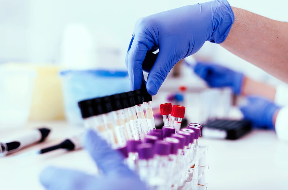 Drug testing in a lab Drug testing in a lab