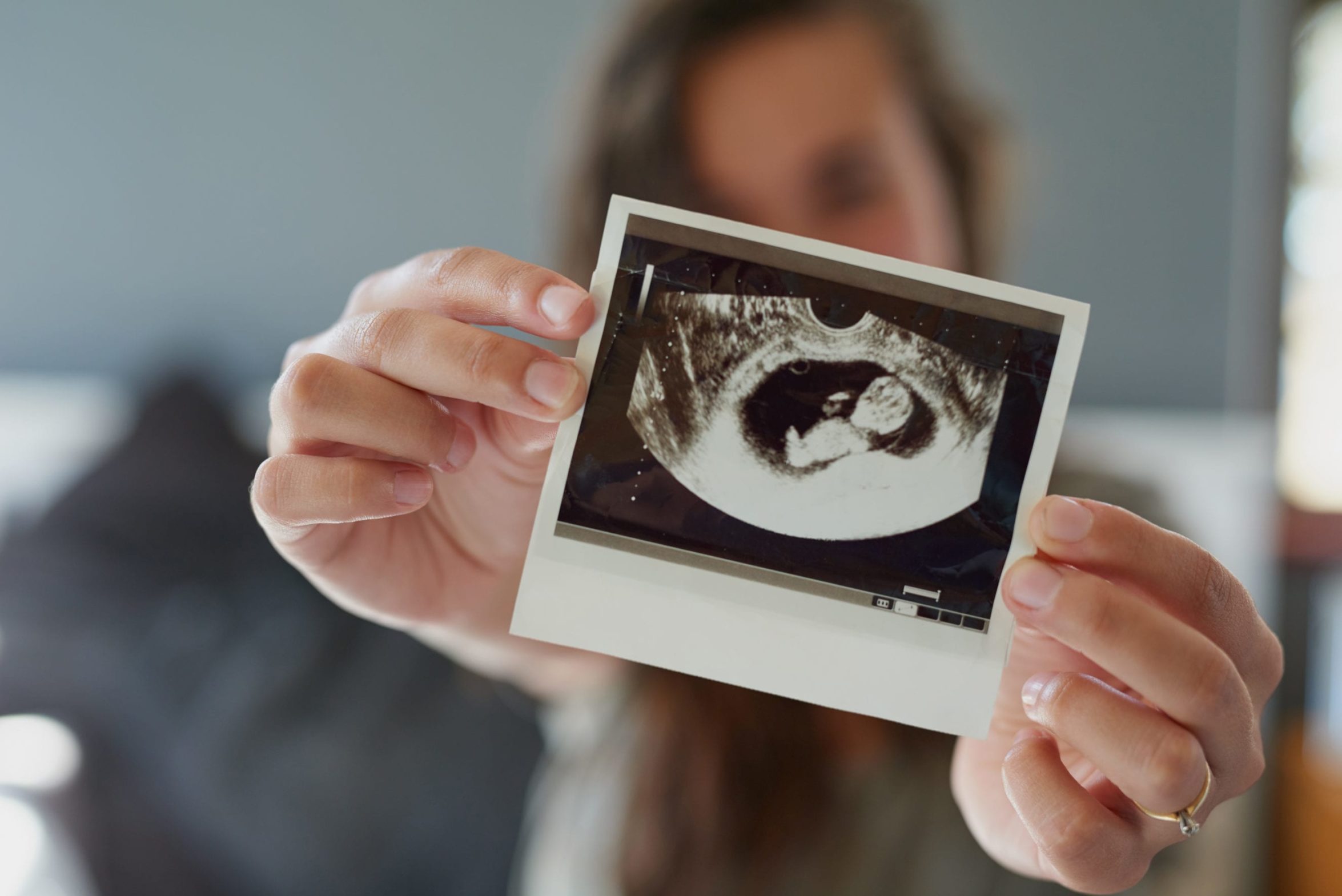 Shot of a woman holding a sonogram of her unborn baby