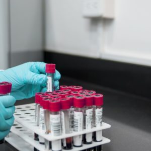 Importance of Lab Testing for Accurate Results