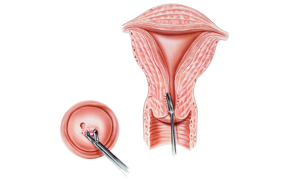 Pap-Smear-Womens-health-screening