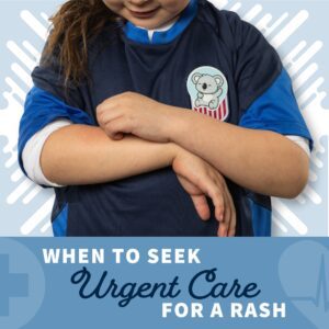 When To Seek Urgent Care for A Rash