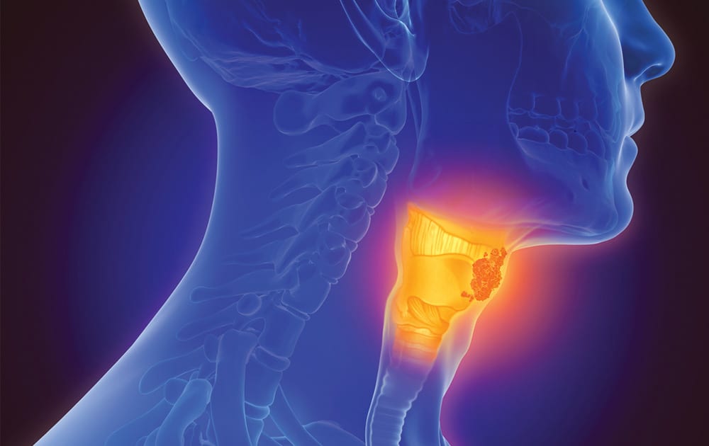 sore-throat-tests-treatment